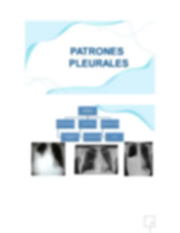 pf48