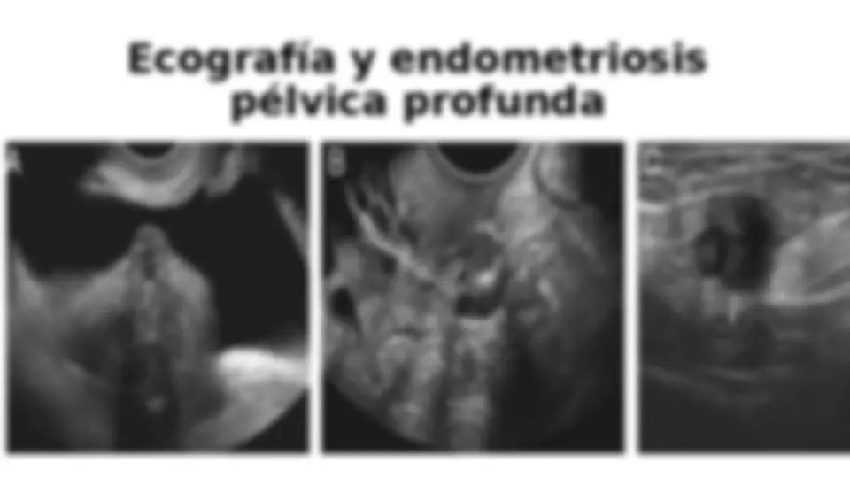 pf4