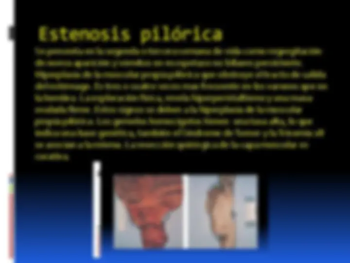 pf16