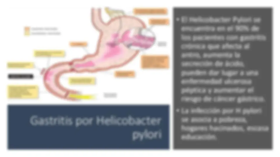 pf44