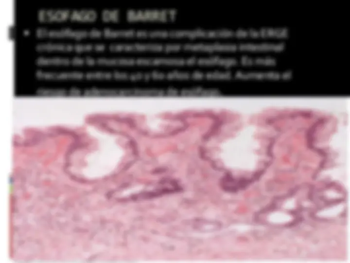 pf28