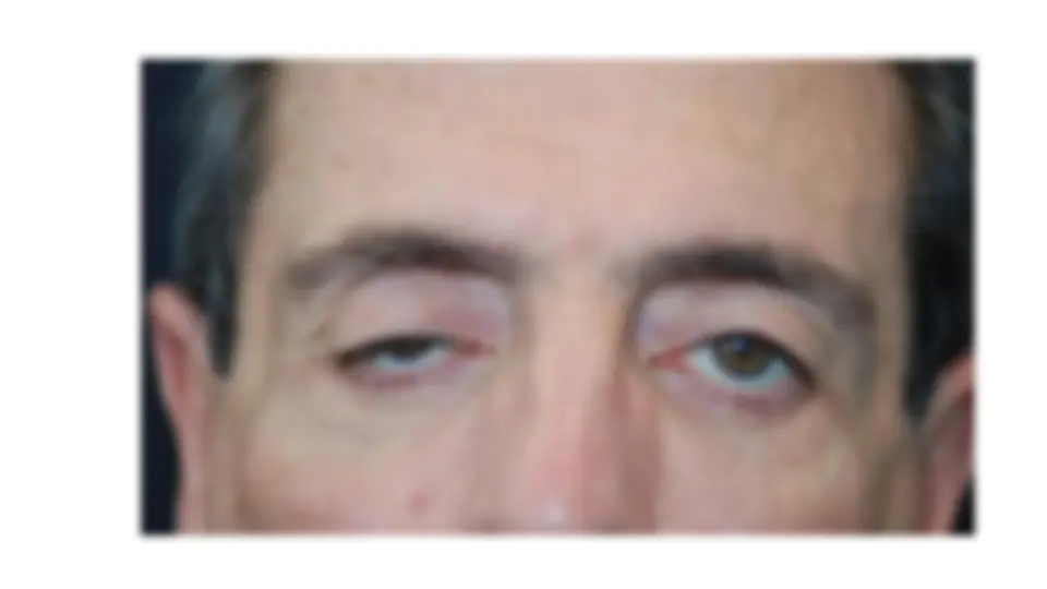 pff
