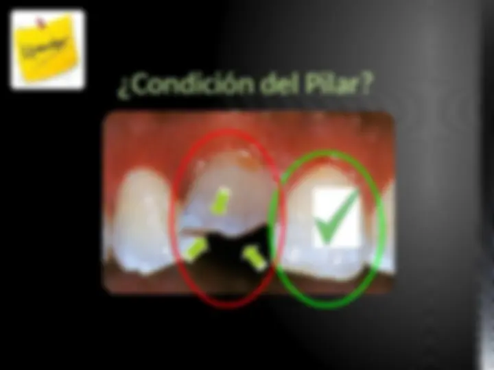 pf4