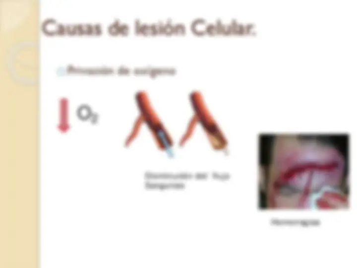 pf27