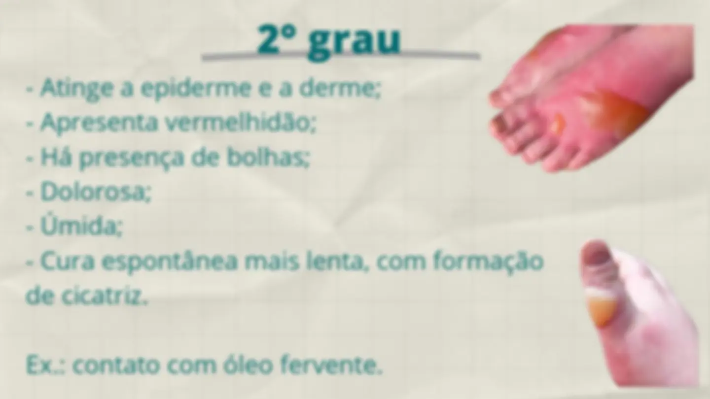 pf4