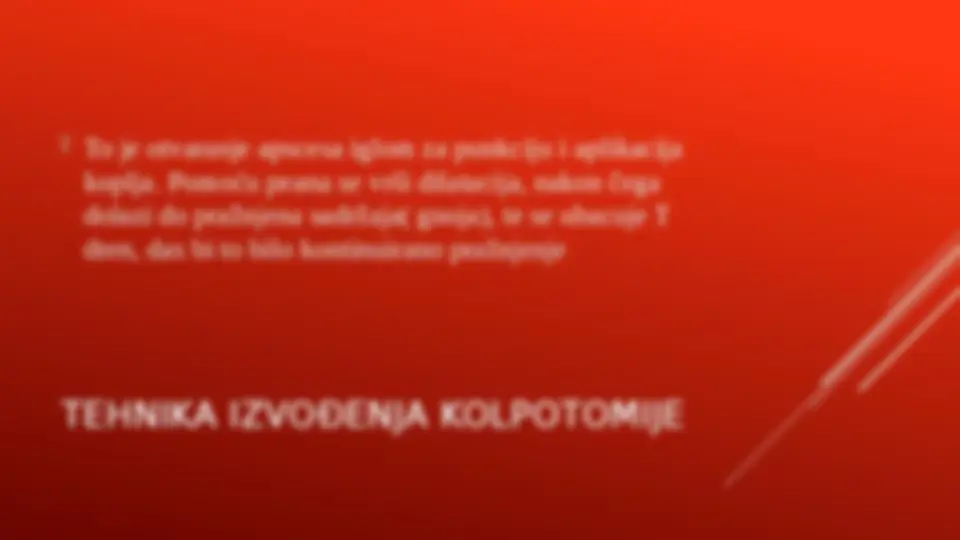 pfe