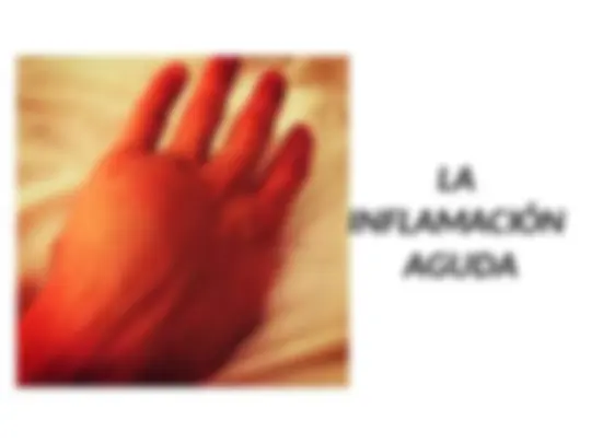 pfe
