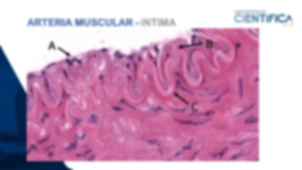 pf1a