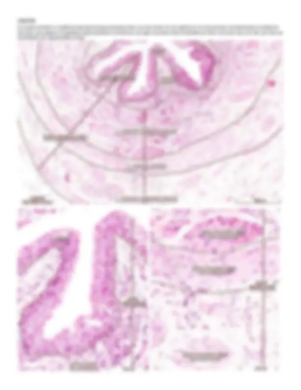 pfa