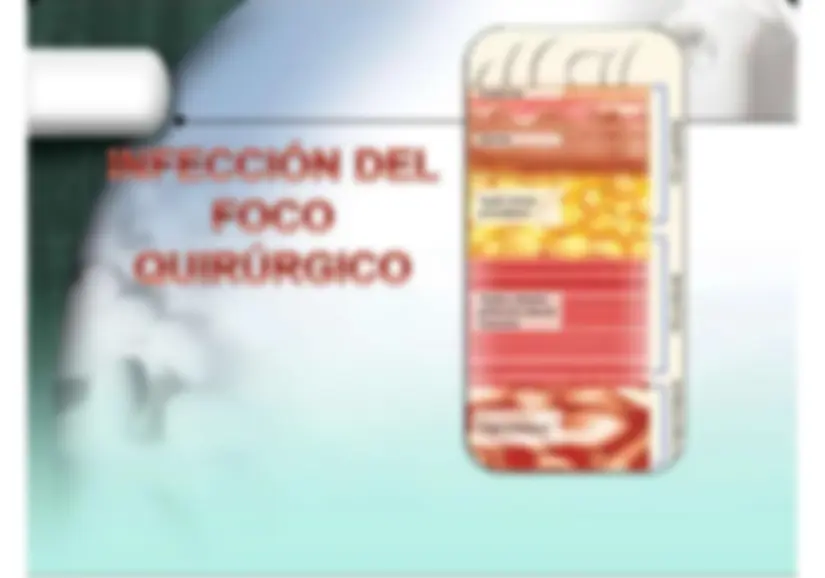 pfa
