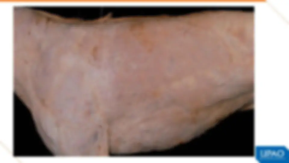pf26