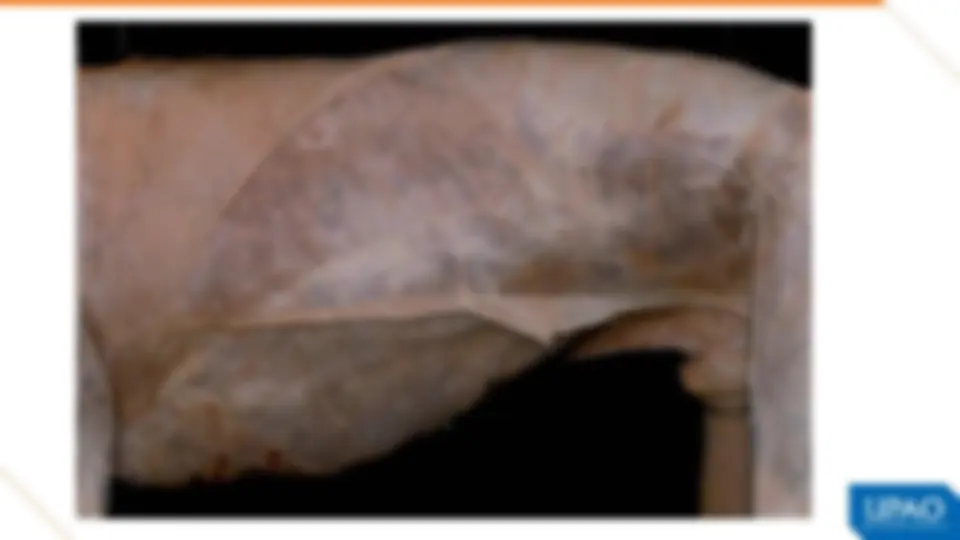 pf28