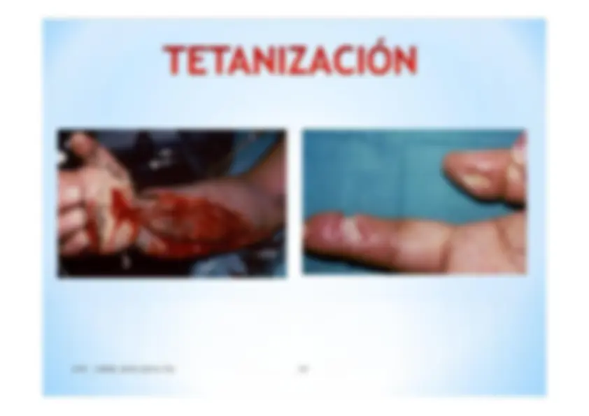 pfe
