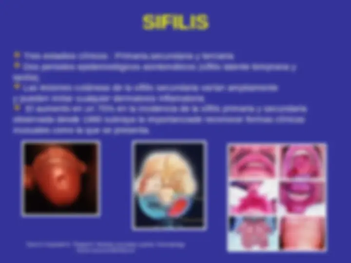pf3