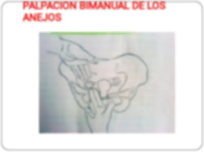 pf1b