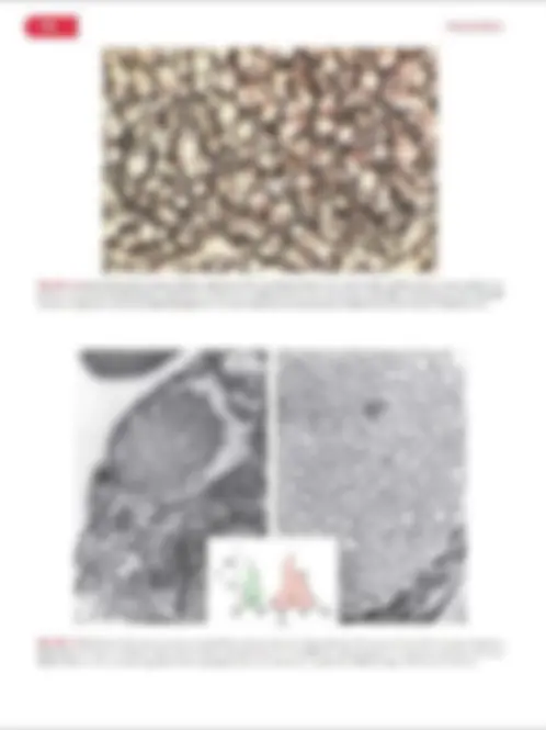 pf12