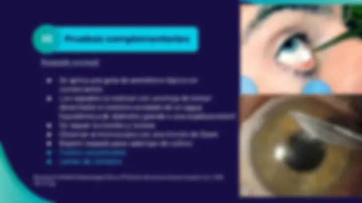 pfe