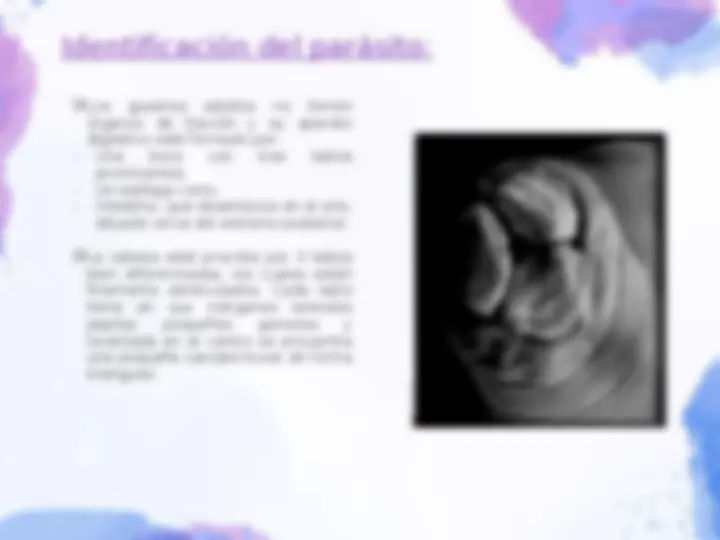 pfe