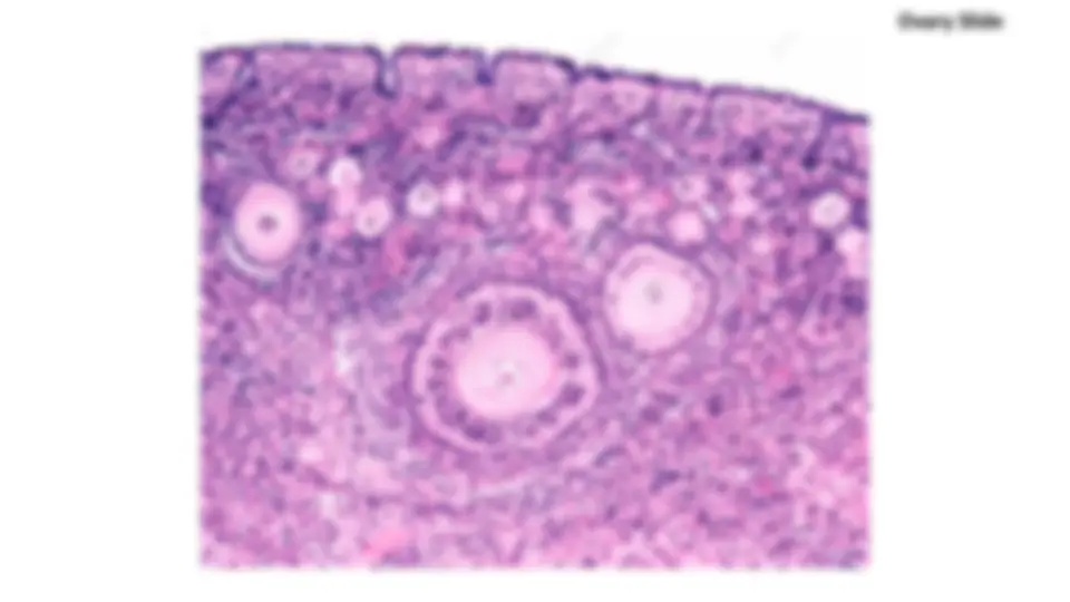 pf5e