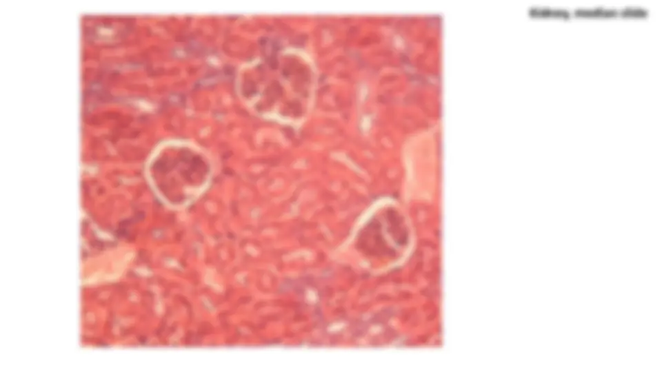 pf1a