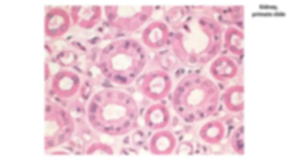 pf1c