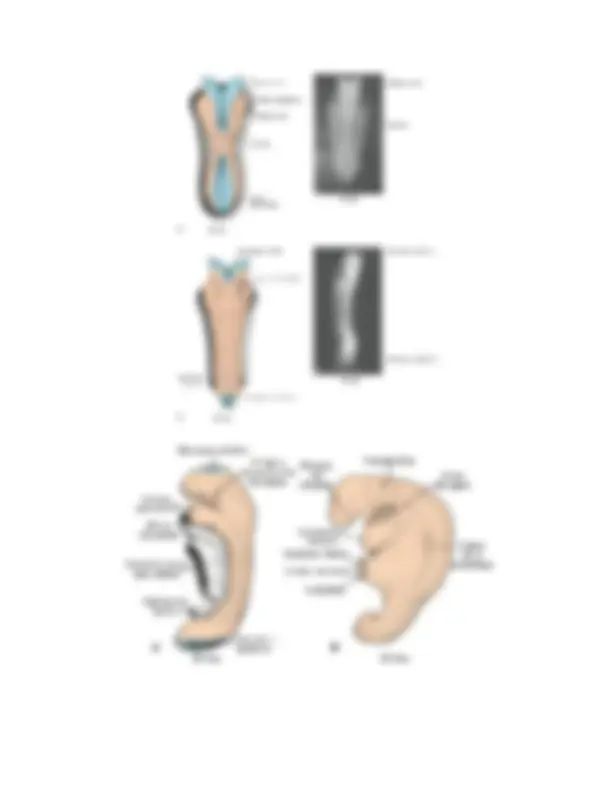 pfa