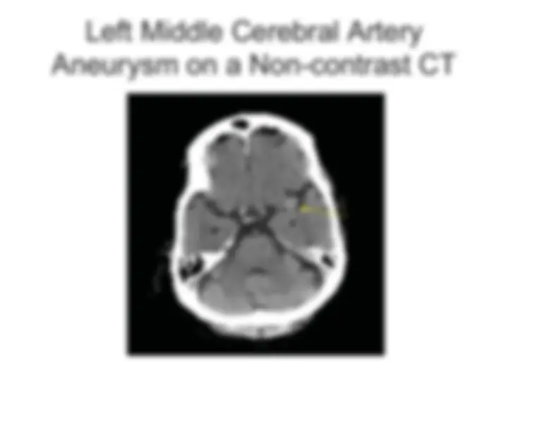Head Ct Notes.pdf BASIC APPROACH TO EVALUATING A HEAD CT | Study notes Anatomy | Docsity