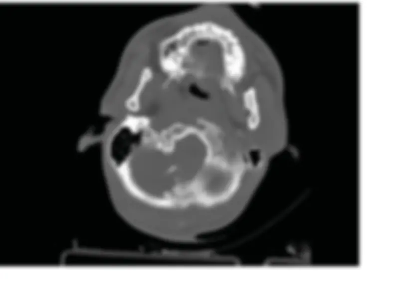 Head Ct Notes.pdf BASIC APPROACH TO EVALUATING A HEAD CT | Study notes Anatomy | Docsity