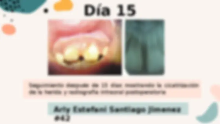 pf19