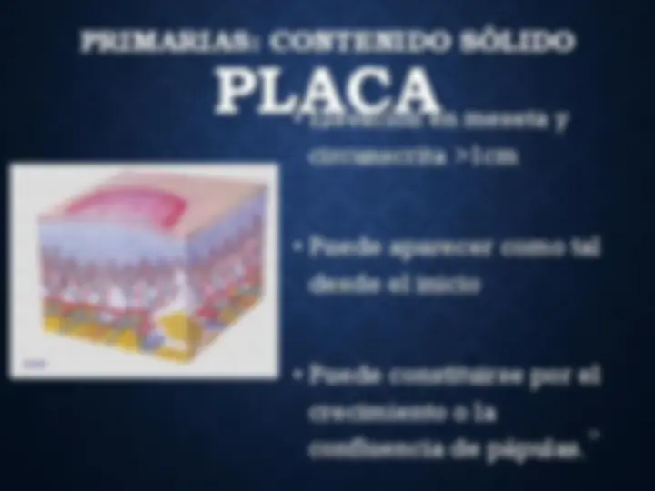 pf12