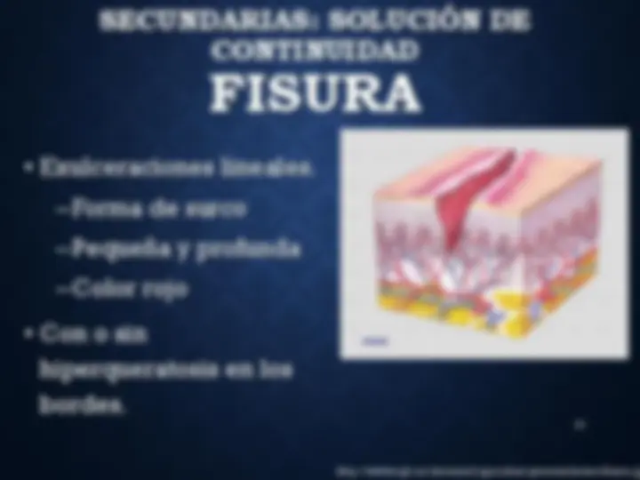pf35