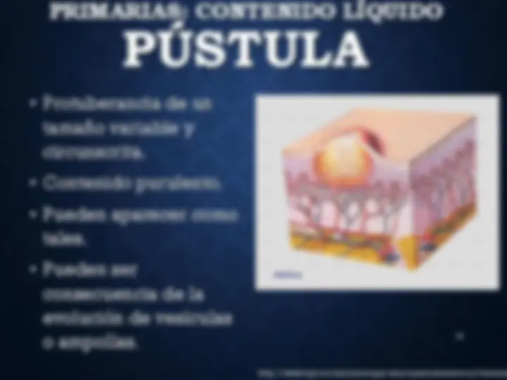 pf24