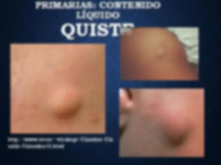 pf28