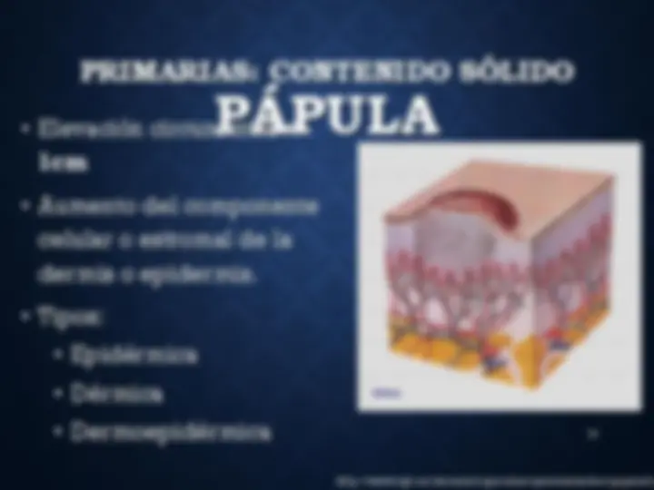 pfe