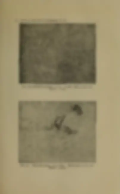 pf25