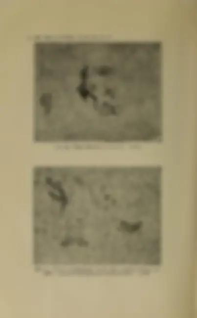 pf28