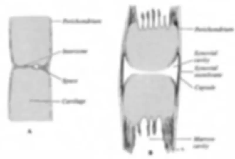 pf1a
