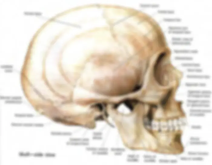 pf31