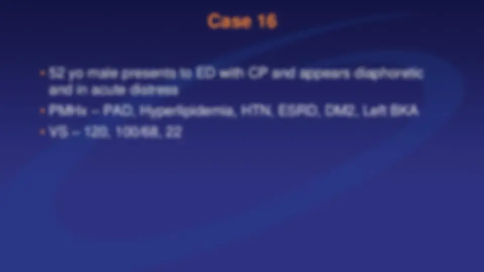 pf5e