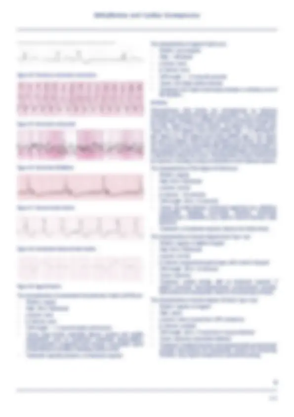 pf5