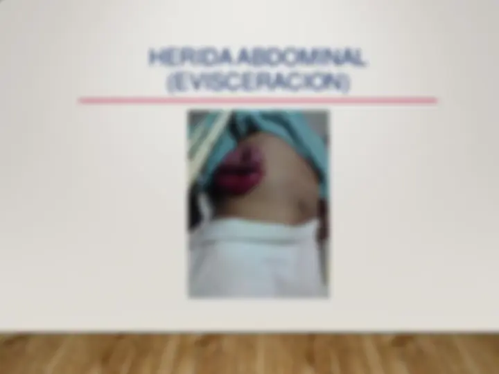 pf19