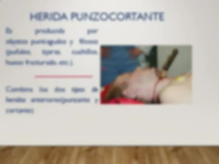 pfd