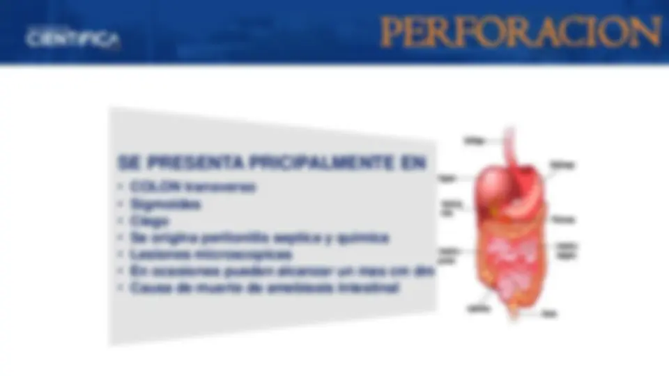 pf29