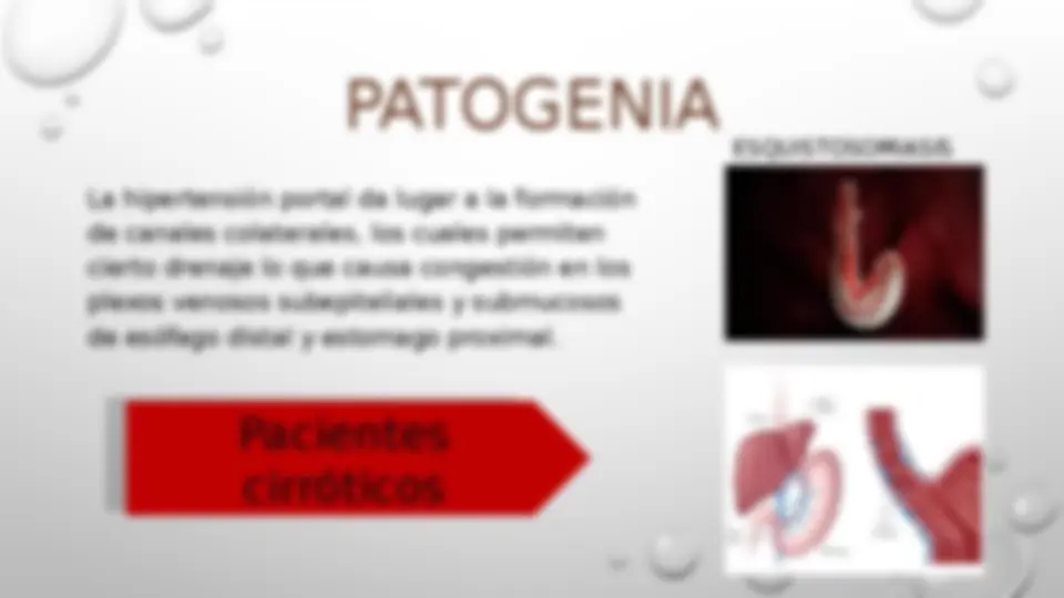 pfe