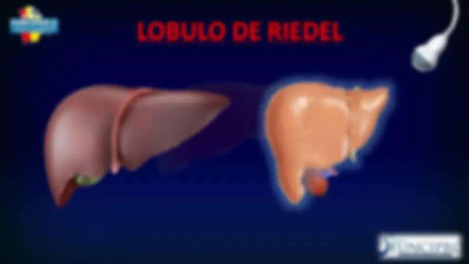 pf19