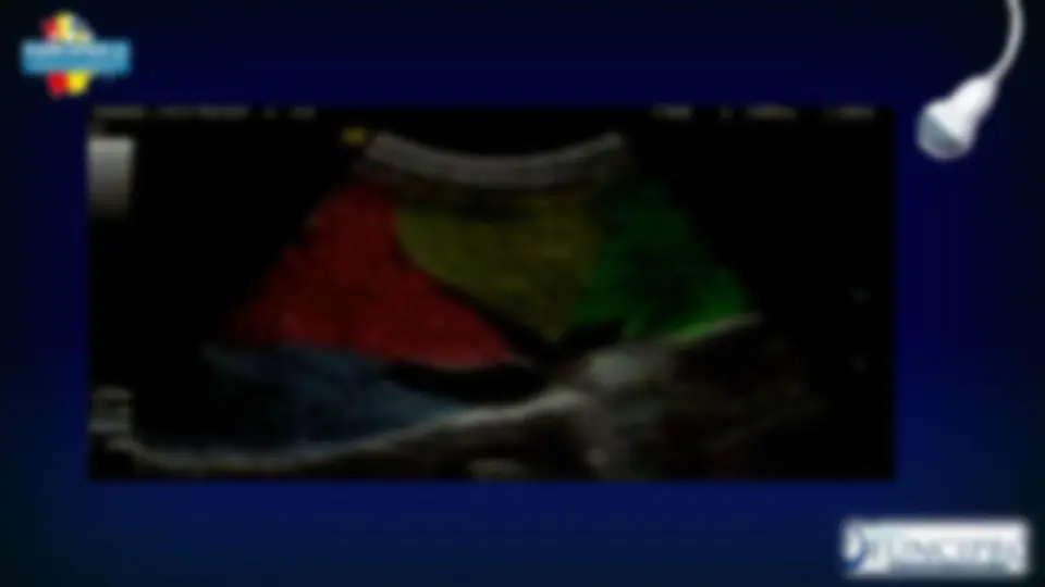 pf32