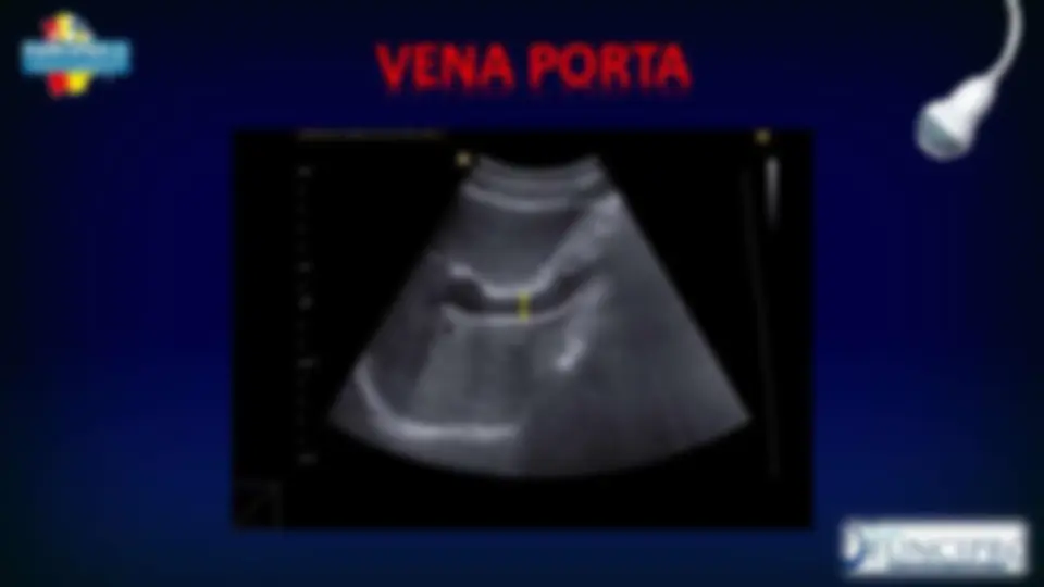 pf1e