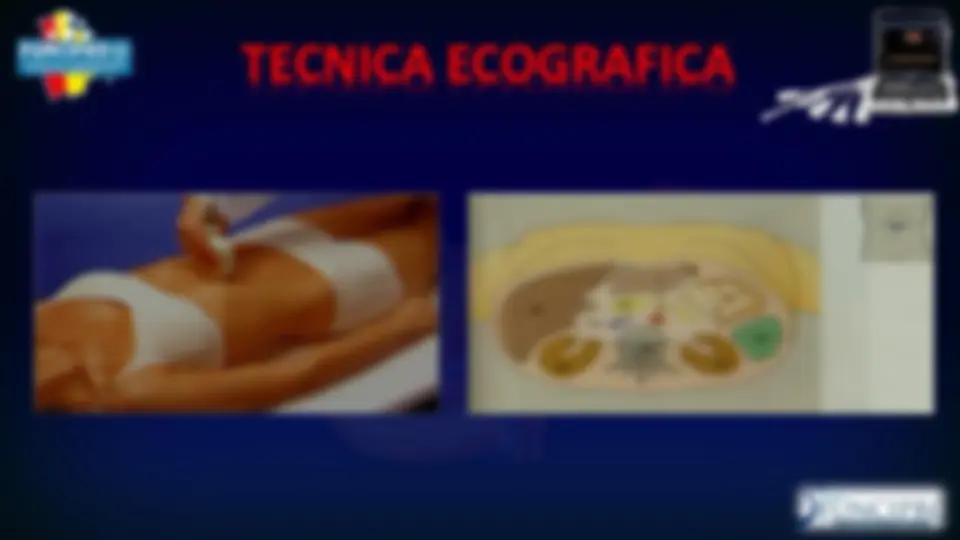 pfe
