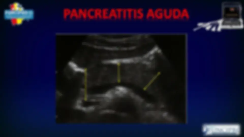 pf15