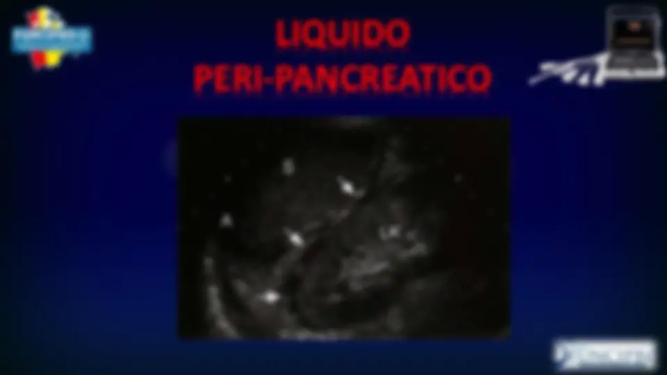 pf19